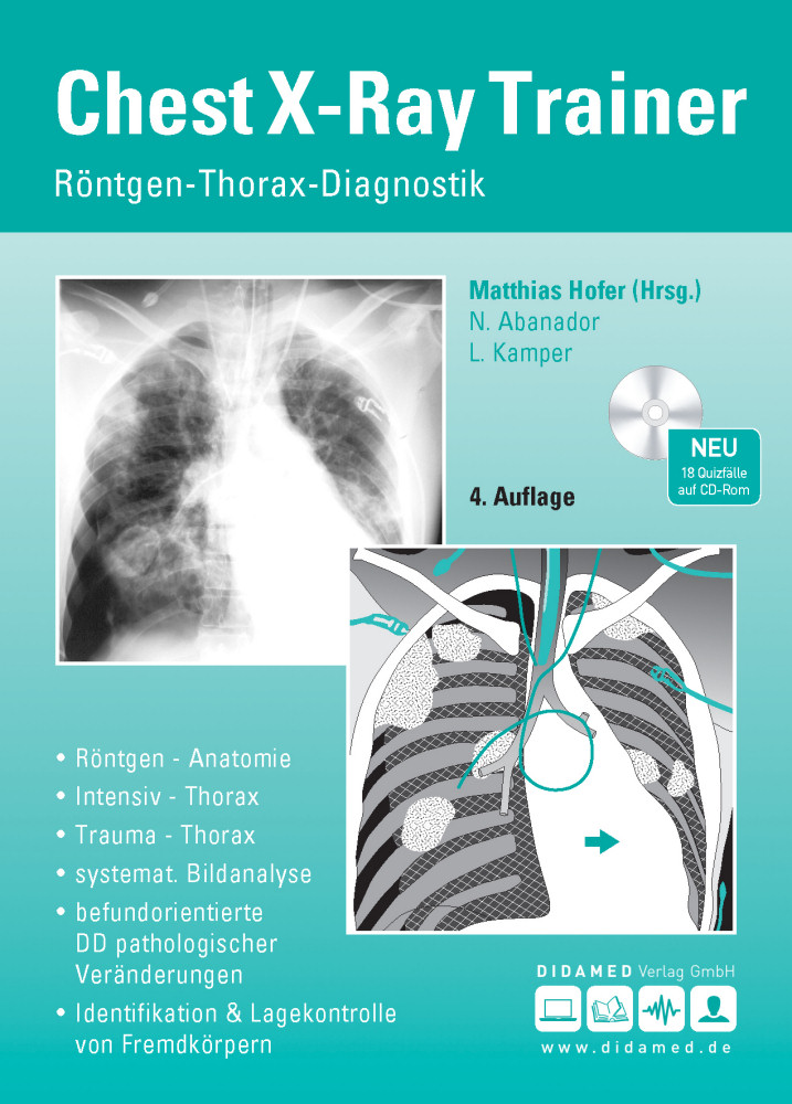 Flyer Chest X-Ray Trainer