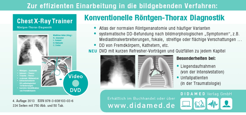 CXR-Flyer