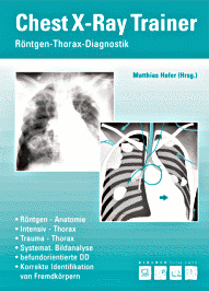 Chest-X-Ray