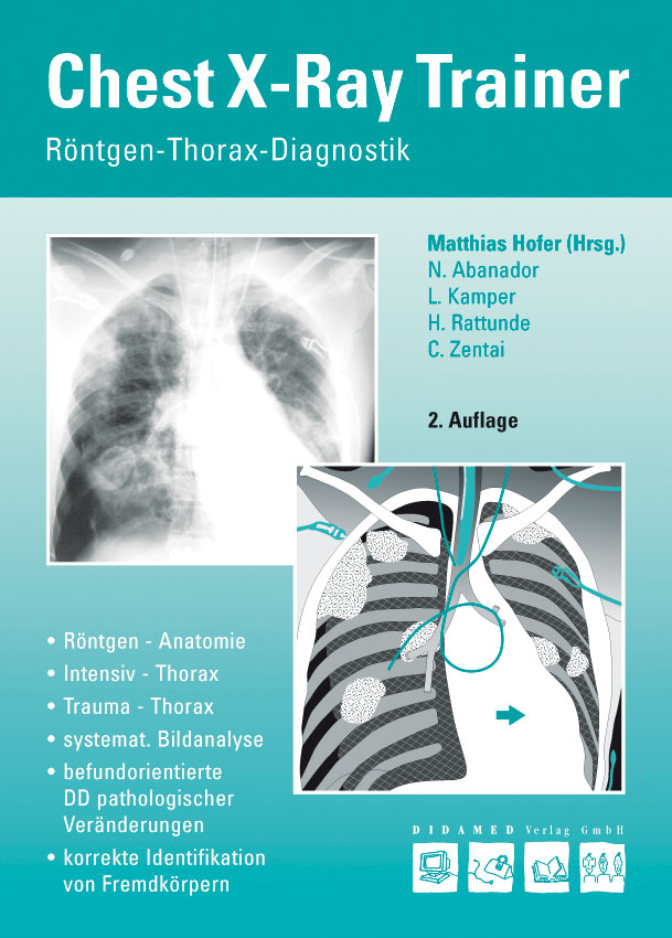 Flyer Chest X-Ray Trainer
